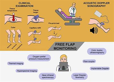 Postoperative free flap monitoring in reconstructive surgery—man or machine?